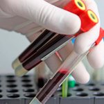 blood test for type 68 virus