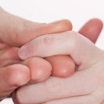 tear off a wart on your finger