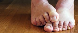 Causes of fungal nail infections and risk factors